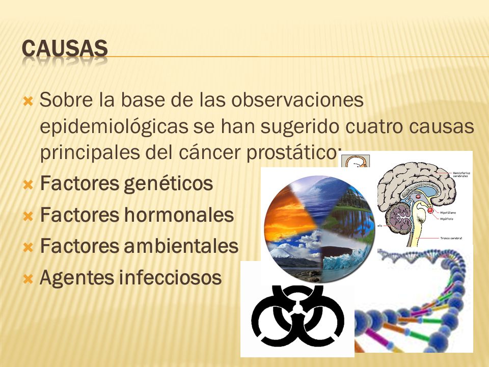 adenocarcinoma de próstata causas de las adenocarcinoma de próstata causas de las